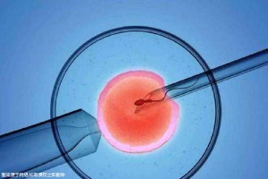 拉拉试管三代代孕机构